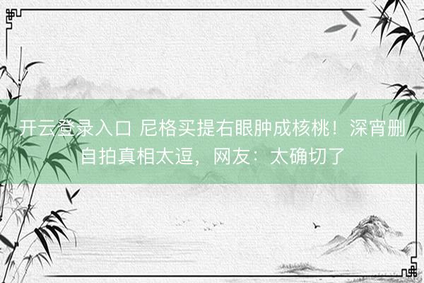 开云登录入口 尼格买提右眼肿成核桃！深宵删自拍真相太逗，网友：太确切了