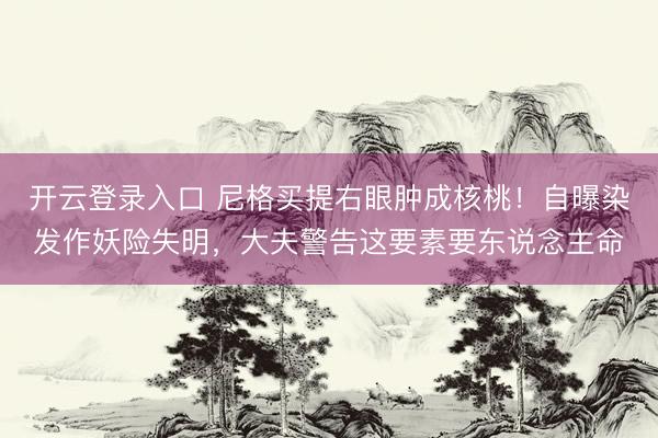 开云登录入口 尼格买提右眼肿成核桃！自曝染发作妖险失明，大夫警告这要素要东说念主命